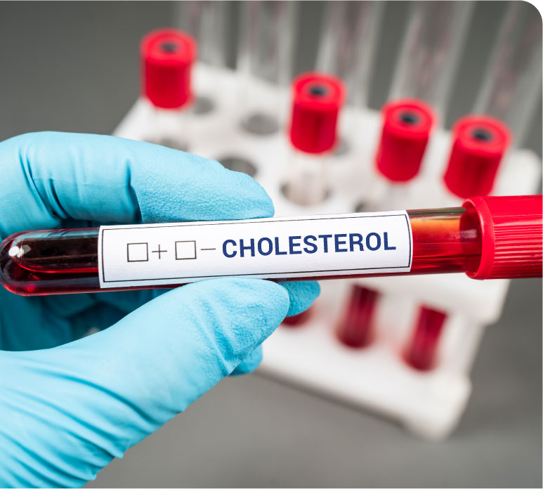 1c_B_Dislipidemia